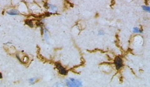 Microglia